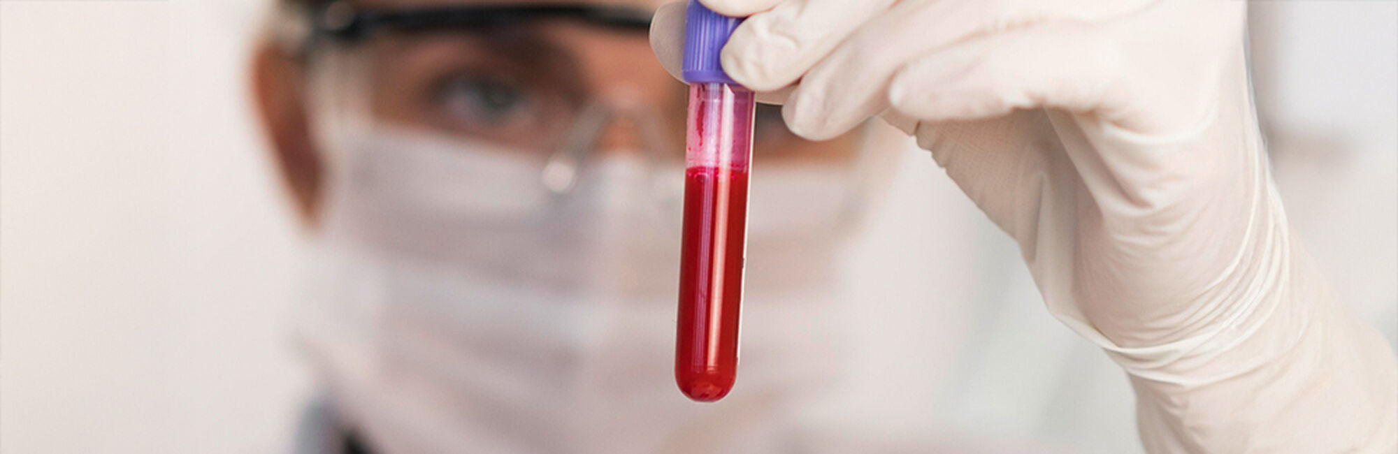 Blood Work Analysis: The Key to Unlocking Elite Transformation…